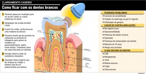 clareamento