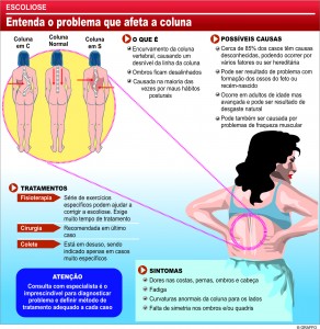 coluna