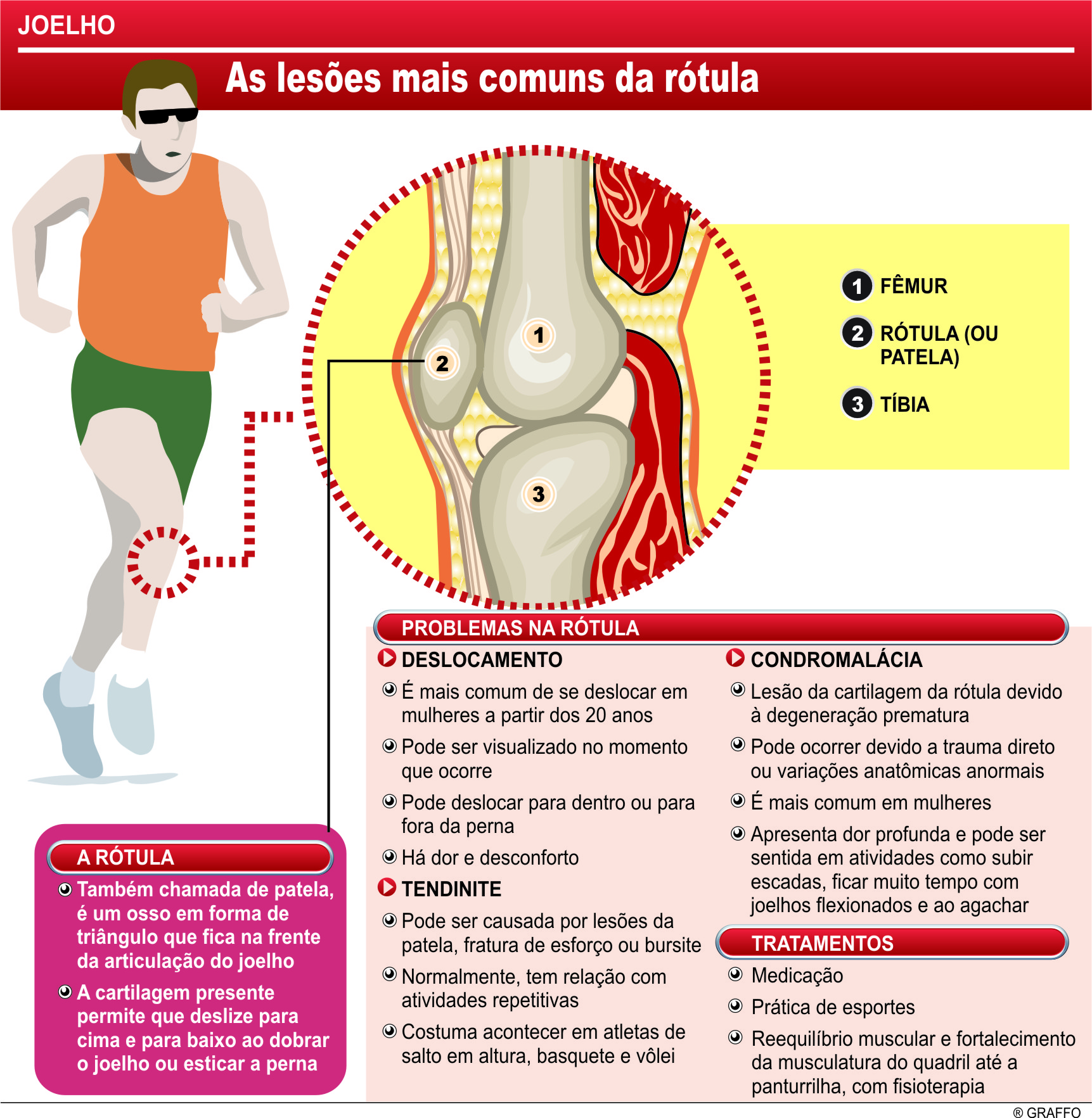 Esportistas sofrem mais com lesões nos joelhos