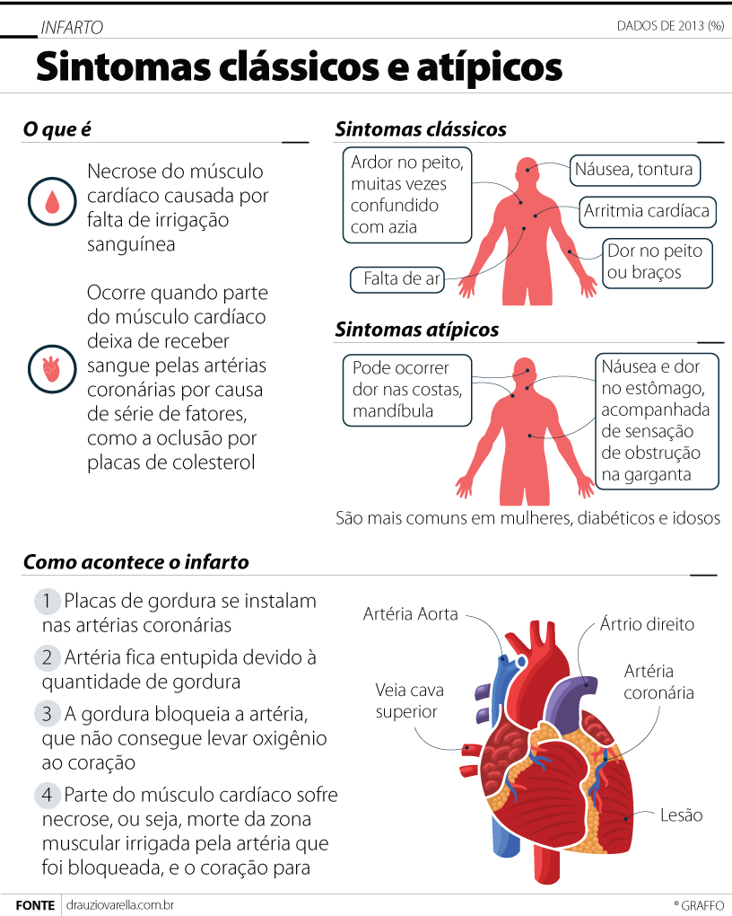 Sintomas e sinais de infarto - Instituto Ellos de Medicina