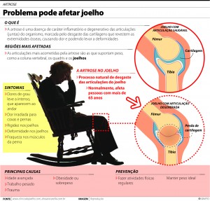 artrose-joelho-saude