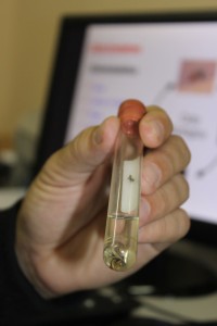 virus-chikunguny-bituruna2