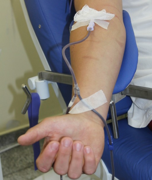 sangue