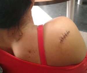 jovem-ferida-agressor-facadas