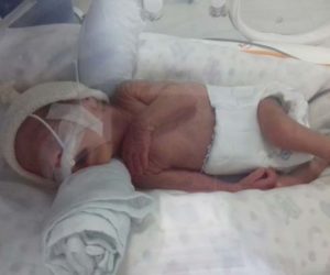 Catarina: nos primeiros dias de vida, na Neonatal 