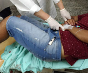 baleado