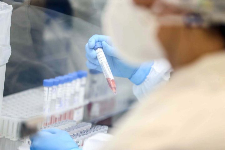 Laboratório Central do Estado - LACEN  -  Recepção  de amostras para teste do Coronavirus. (Foto: Geraldo Bubniak/AEN).