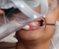 Brasil Sorridente inclui polÃ­tica nacional de saÃºde bucal no SUS