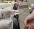 No ParanÃ¡, o Centro de Hematologia e Hemoterapia do ParanÃ¡ (Hemepar) Ã© responsÃ¡vel por 95,6% do estoque dos leitos do Sistema Ãnico de SaÃºde (SUS), abastecendo 375 hospitais, pÃºblicos, privados ou filantrÃ³picos | Foto: Venilton KÃ¼chler/SESA